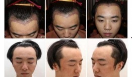 整容爆料大全视频播放,揭秘“整容爆料大全”视频播放背后的真相