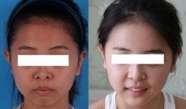 爆料明星打美白针视频,揭秘打针背后的真相